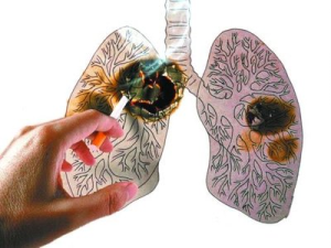 西米普利单抗（Cemiplimab）是进口药吗，效果怎么样